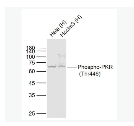 Anti-Phospho-PKR antibody  -磷酸化干擾素誘導(dǎo)的雙鏈RNA活化蛋白激酶重組兔單克隆抗體,Phospho-PKR (Thr446)