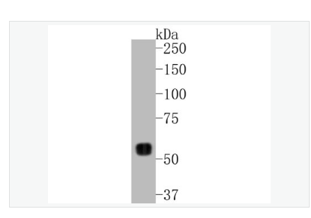 Anti-MMP14 antibody  -基質(zhì)金屬蛋白酶-14重組兔單克隆抗體,MMP14