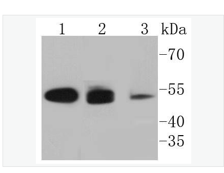 Anti-Cytokeratin 8 antibody  -细胞角蛋白8重组兔单克隆抗体,Cytokeratin 8