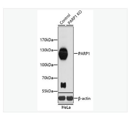 Anti-HDAC1  antibody  -组蛋白去乙酰化酶1抗体,HDAC1