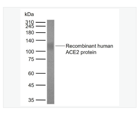 Anti-ACE2  antibody  -血管紧张素转换酶2单克隆抗体,ACE2