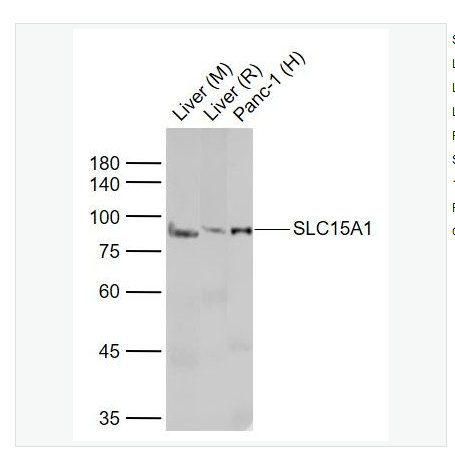 Anti-SLC15A1 antibody  -肠道肽转运蛋白1/小肽转运蛋白1抗体,SLC15A1