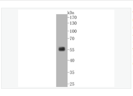 Anti-SGK1 antibody  -糖皮质激素调节激酶1重组兔单克隆抗体,SGK1