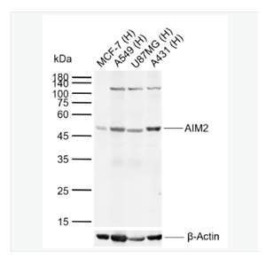 Anti-AIM2 antibody   -干扰素诱导蛋白AIM2抗体