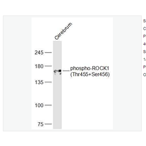 Anti-phospho-ROCK1 antibody   -磷酸化Rho相关蛋白激酶1抗体