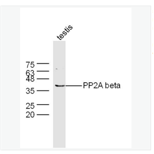 Anti-PP2A alpha + beta antibody   -蛋白质磷酸酶2A （alpha + beta）抗体