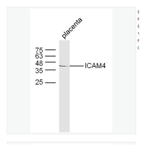 Anti-ICAM4antibody   -细胞间粘附分子4抗体