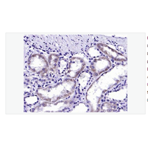 Anti-ALAS1 antibody   -5-氨基乙酰丙酸合酶1抗体