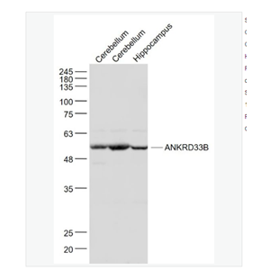 Anti-ANKRD33B antibody  -锚蛋白重复结构域蛋白33B抗体,ANKRD33B
