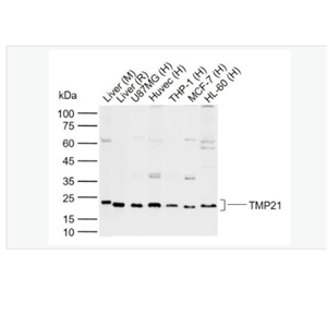 Anti-TMP21 antibody  -跨膜转运蛋白21抗体