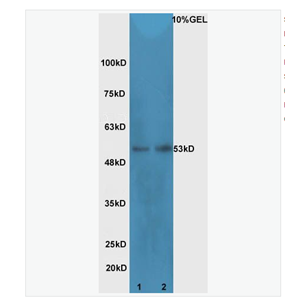 Anti-Cdc25C antibody  -细胞分裂周期蛋白25C抗体
