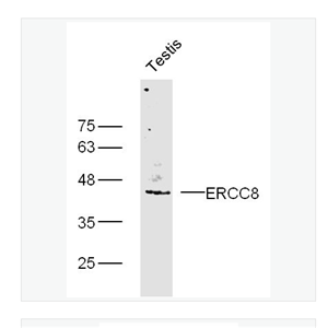 Anti-ERCC8 antibody  -科凯恩氏综合症相关蛋白/早衰蛋白CSA抗体