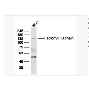 Anti-Factor VIII B chain  antibody  -凝血因子8/第八凝血因子/第八因子相关抗原抗体