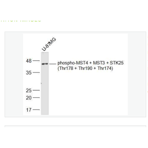 Anti-phospho-MST4 + MST3 + STK25 antibody  -磷酸化丝氨酸/苏氨酸蛋白激酶MST4,MST3,STK25抗体