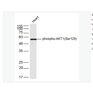 Anti-phospho-AKT1antibody  -磷酸化蛋白激酶B抗体