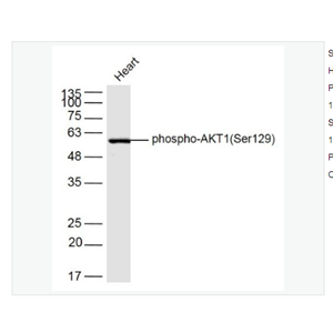 Anti-phospho-AKT1antibody  -磷酸化蛋白激酶B抗体,phospho-AKT1 (Ser129)