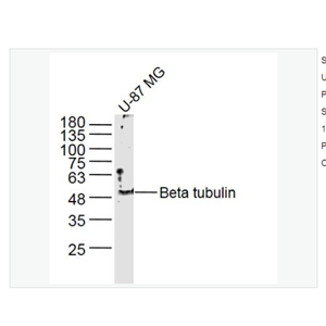 Anti-Beta tubulinantibody  -微管蛋白β tubulin/Tubulin β抗体