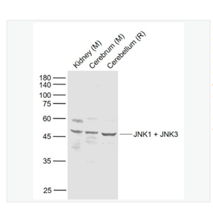 Anti-JNK1 + JNK3 antibody  -氨基末端激酶1/3抗体,JNK1 + JNK3