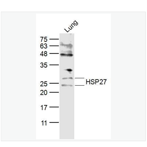 Anti-HSP27  antibody  -热休克蛋白27抗体
