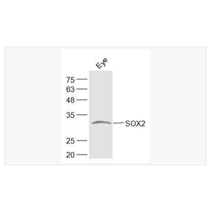 Anti-SOX2  antibody  -胚胎干细胞关键蛋白抗体