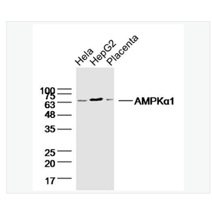 Anti-AMPK alpha-1  antibody  -腺苷单磷酸活化蛋白激酶α1/AMPK α 1单克隆抗体,AMPK alpha-1