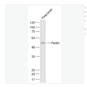 Anti-Parkin antibody  -帕金蛋白抗体,Parkin