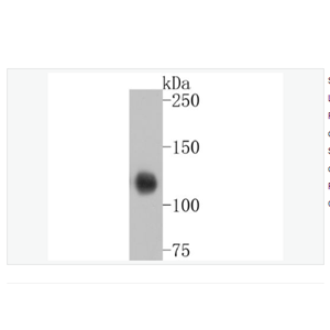 Anti-Collagen XVII antibody  -胶原蛋白17重组兔单克隆抗体