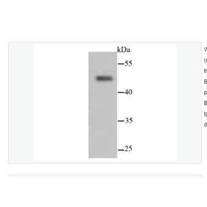 Anti-Cytokeratin 13 antibody  -细胞角蛋白13重组兔单克隆抗体