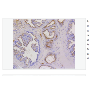 Anti-Cytokeratin 17 antibody  -细胞角蛋白17重组兔单克隆抗体