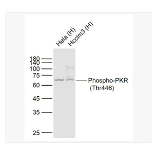 Anti-Phospho-PKR antibody  -磷酸化干扰素诱导的双链RNA活化蛋白激酶重组兔单克隆抗体