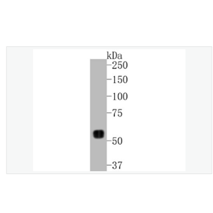 Anti-MMP14 antibody  -基质金属蛋白酶-14重组兔单克隆抗体
