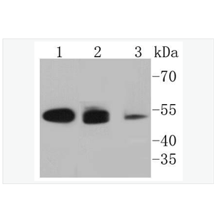 Anti-Cytokeratin 8 antibody  -细胞角蛋白8重组兔单克隆抗体