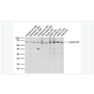 Anti-Lamin B1 antibody  -核纤层蛋白B重组兔单克隆抗体