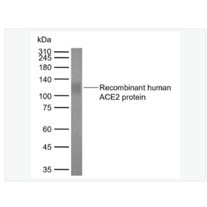 Anti-ACE2  antibody  -血管紧张素转换酶2单克隆抗体