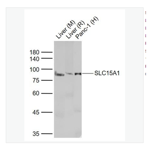 Anti-SLC15A1 antibody  -肠道肽转运蛋白1/小肽转运蛋白1抗体