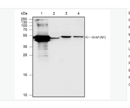 Anti-GFAP antibody  -胶质纤维酸性蛋白重组兔单克隆抗体,GFAP