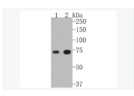 Anti-TAK1/MAP3K7  antibody  -转化生长因子β活化激酶1抗体,TAK1/MAP3K7