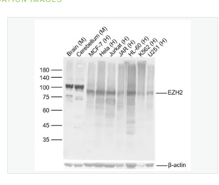Anti-EZH2  antibody  -抑癌蛋白EZH2重组兔单克隆抗体,EZH2