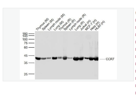 Anti-CCR7  antibody  -细胞表面趋化因子受体7重组兔单克隆抗体,CCR7