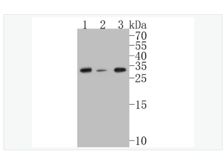 Anti-CHMP2B antibody  -染色质修饰蛋白2B重组兔单克隆抗体,CHMP2B