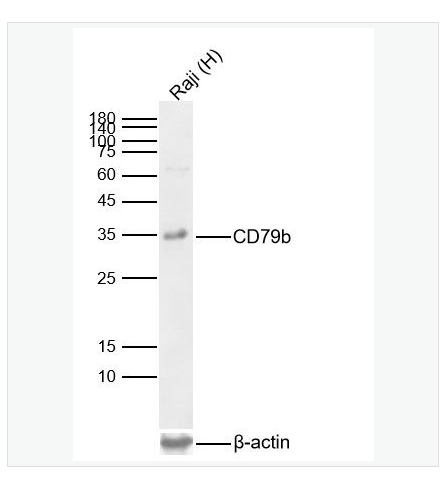 Anti-CD79b antibody  -CD79b重组兔单克隆抗体,CD79b