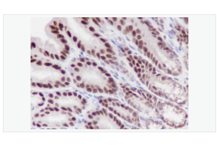 Anti-XRCC5/Ku80 antibody  -DNA修复酶Ku-80重组兔单克隆抗体,XRCC5/Ku80