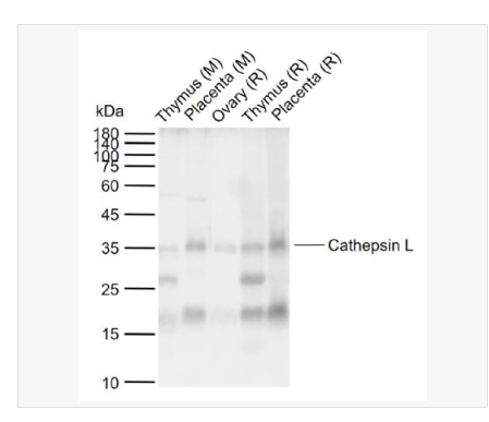 Anti-Cathepsin L  antibody  -组织蛋白酶L抗体,Cathepsin L
