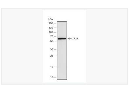 Anti-CBX4 antibody  -染色盒同源物4重組兔單克隆抗體,CBX4