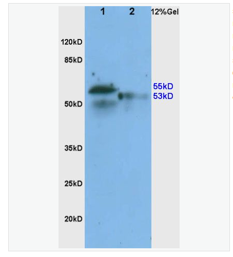 Anti-ADRB1  antibody  -肾上腺素能受体β1抗体,ADRB1