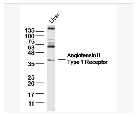 Anti-Angiotensin II Type 1 Receptor  antibody  -血管緊張素Ⅱ-1型受體抗體,Angiotensin II Type 1 Receptor