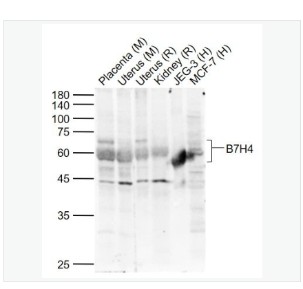 Anti-B7H4  antibody  -B7-H4抗体,B7H4