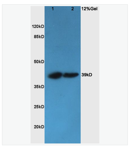 Anti-CHI3L1   antibody  -軟骨糖蛋白39抗體,CHI3L1