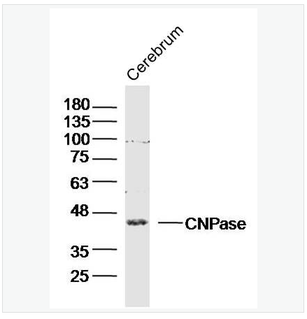 Anti-CNPase antibody  -2’,3’-环腺苷酸-3’-磷酸二酯酶抗体,CNPase