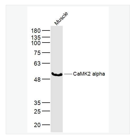 Anti-CaMK2 alpha antibody  -钙/钙调素依赖蛋白激酶2α抗体,CaMK2 alpha